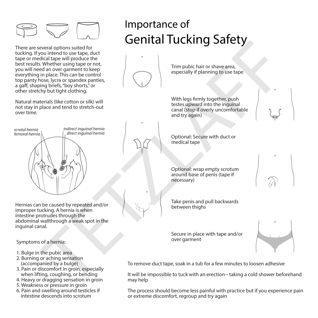 Educational illustrated pamphlet on importance of genital tucking safety